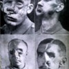 Lesões faciais, Primeira Guerra.